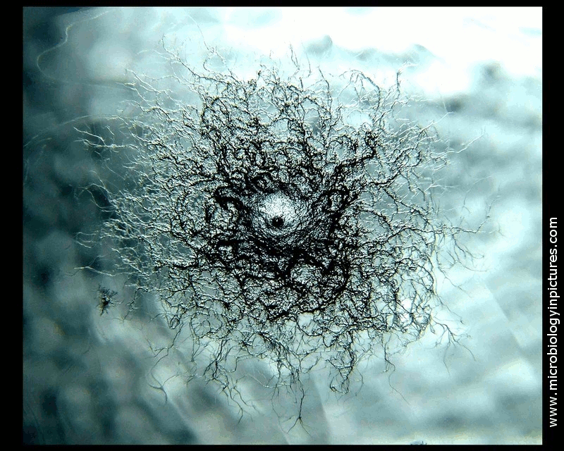 bacterial colony